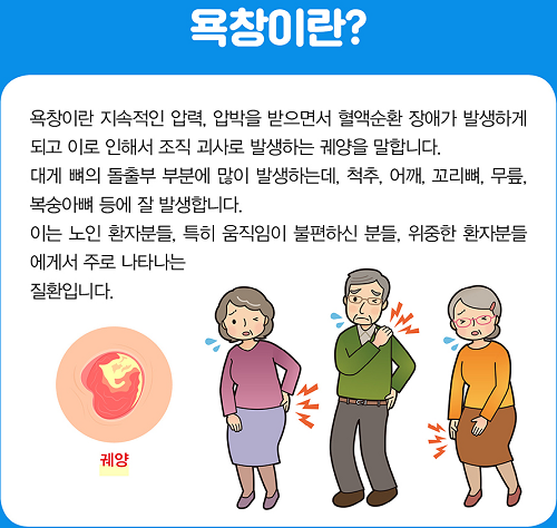 욕창이란 무엇인가?